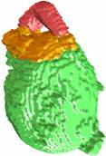 Volume Rendering of Bladder